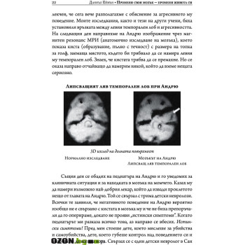 Промени своя мозък - промени живота си